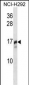 TRAPPC2 Antibody (N-term)